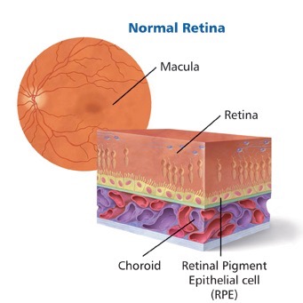 Diagram of normal retina with a cross section showing the retina, the choroid and retinal pigment epithelial cell layer